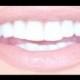 Как получить Действительно Белые зубы Для скидками
