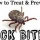 Zeckenbissen und Lyme-Borreliose Symptome