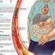 Metabolic Syndrome Anatomy Poster