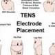Tens Unit For All Areas Of Pain