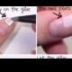 How To Fix A Broken Finger Nail
        