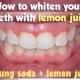 WE HEART IT: 5 Steps To Whiten Teeth With Lemon Juice