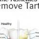 15 Amazing Home Remedies To Remove Tartar