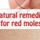 Natural Remedies For Red Moles