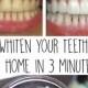 Whiten Your Teeth At Home In 3 Minutes