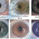 Examples Of Main Iris Markings/Rings