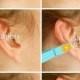 How To: Ear Reflexology Using A Clothespin