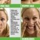 Yoga Exercises To Target Facial Wrinkles 