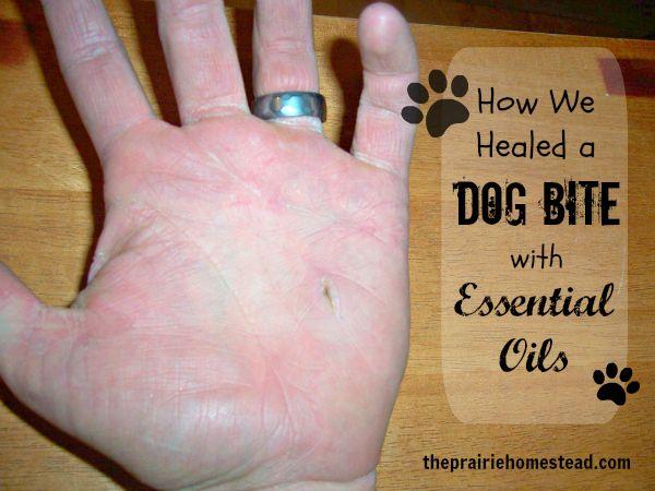 Wedding - How We Treated A Dog Bite With Essential Oils