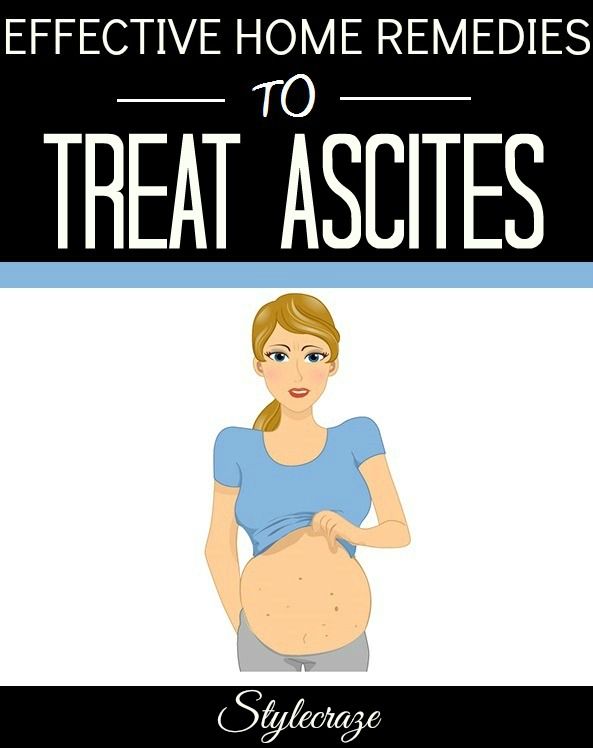 Wedding - 25 Effective Home Remedies To Treat Ascites