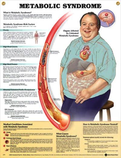 Mariage - Syndrome métabolique anatomie affiche