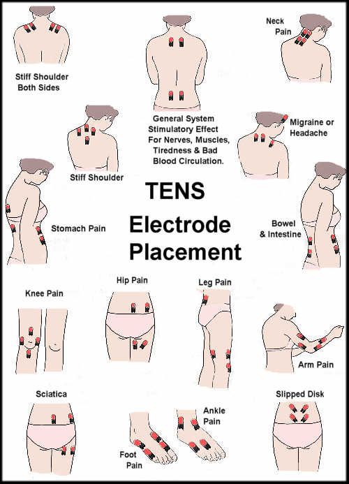 زفاف - Tens Unit For All Areas Of Pain