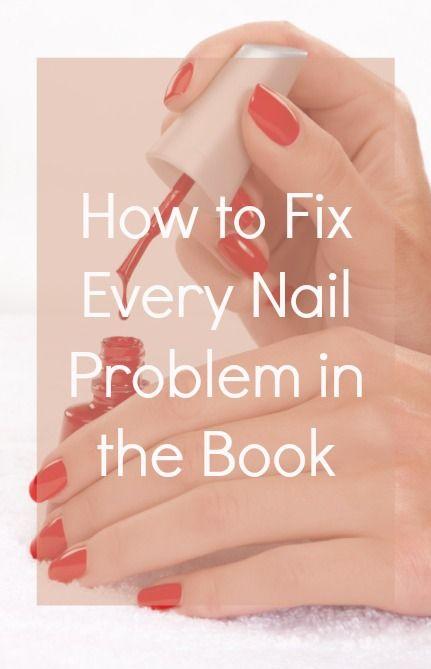 Mariage - How To Fix Every Nail Problem In The Book