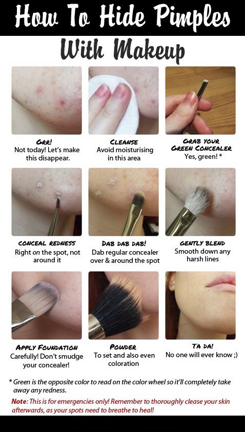 Hochzeit - How To Hide Pimples With Makeup