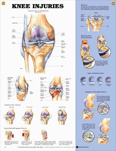 زفاف - Knee Injuries Anatomy Poster