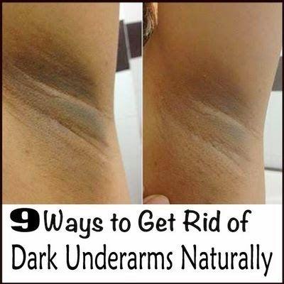 Hochzeit - Natural Ways To Get Rid Of Dark Underarms