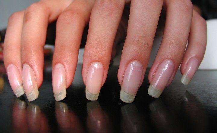 Свадьба - Real Asian Beauty: How To Make Nails Grow Stronger And Longer