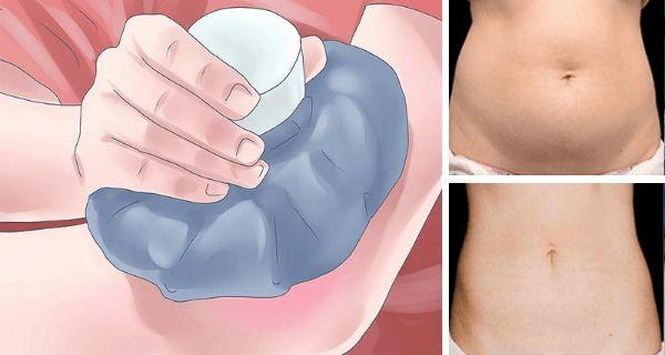 Свадьба - Kill Fat Cells Instantly Just By Freezing Them! ( You'll Never Believe How It Works )