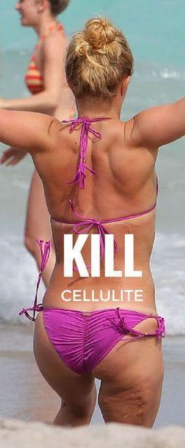 Hochzeit - 5 Critical Ways To Kill Cellulite