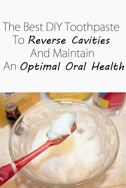 Hochzeit - Health Matters: The Best DIY Toothpaste To Reverse Cavities And Maintain An Optimal Oral Health