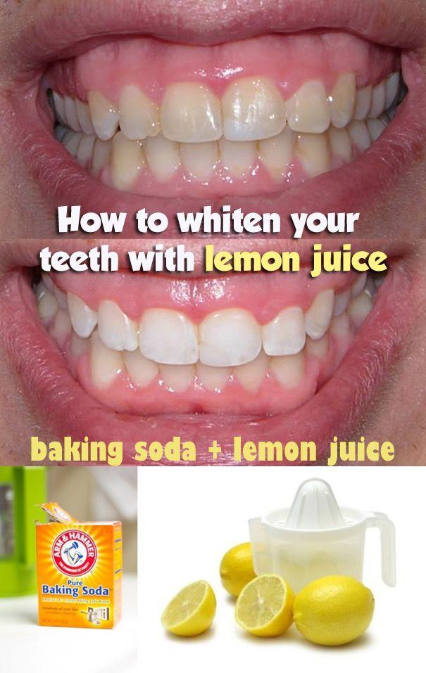 Mariage - WE HEART IT: 5 Steps To Whiten Teeth With Lemon Juice