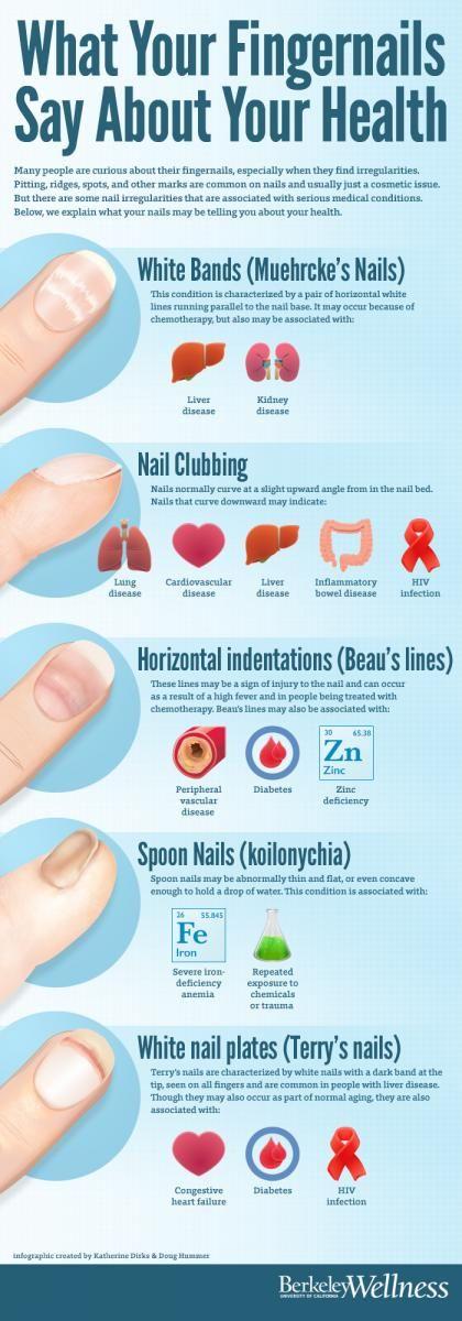 Hochzeit - Fingernails And Your Health [Infographic]