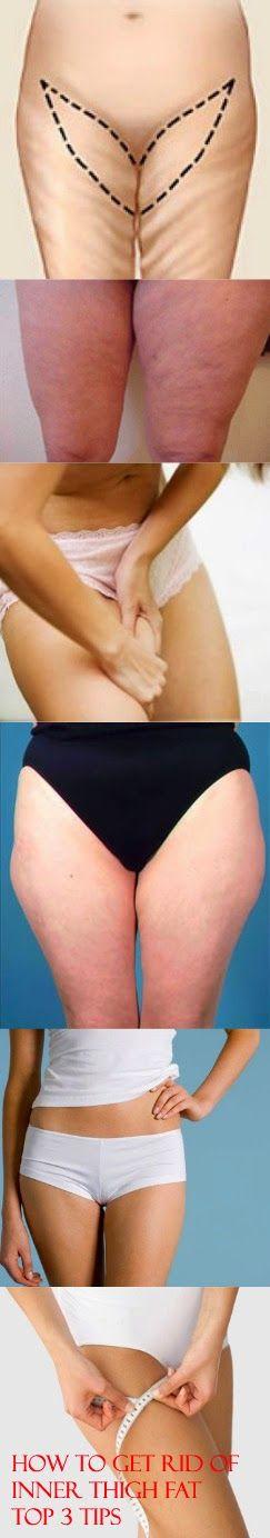 Mariage - How To Get Rid Of Inner Thigh Fat-Top 3 Tips