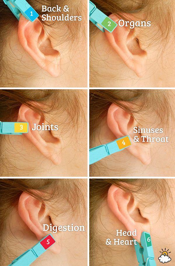 زفاف - How To: Ear Reflexology Using A Clothespin