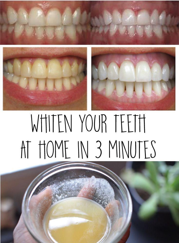 how to whiten your teeth at home