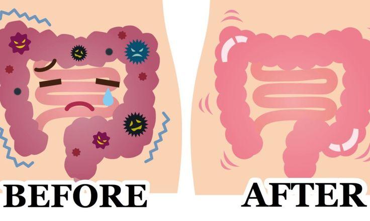 Mariage - This 2 Ingredient Remedy Flushes POUNDS Of Waste From Your Colon