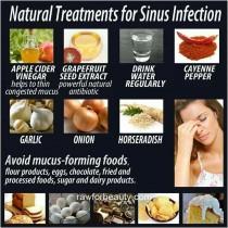 wedding photo - Natural Remedies For Sinus Infections 