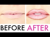 wedding photo - How To Fake (Full) Lip Injections
