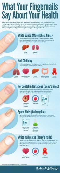 wedding photo - Fingernails And Your Health [Infographic]