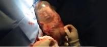 wedding photo - [Vídeo] Un bebé nace sin romper la bolsa amniótica