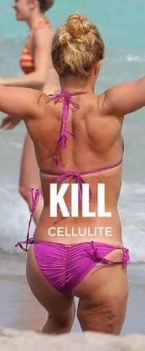 wedding photo - 5 Critical Ways To Kill Cellulite